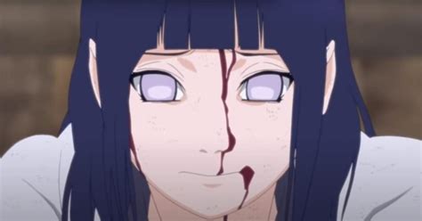 blind hinata|is hinata dead.